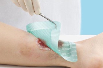 Curso prático de FERIDAS E CURATIVOS